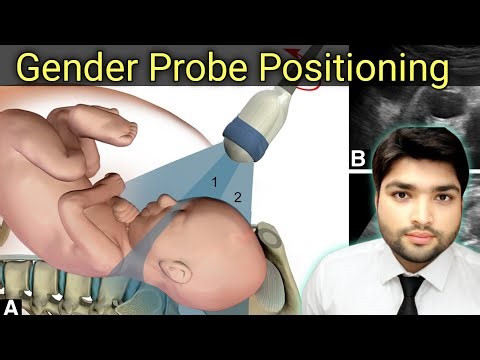 Baby Gender on Ultrasound Scan | Gyne Ultrasound Explained by Dr Ali Waqar
