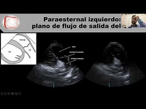 Clase 1. El ecocardiograma normal. Dr Freytes.