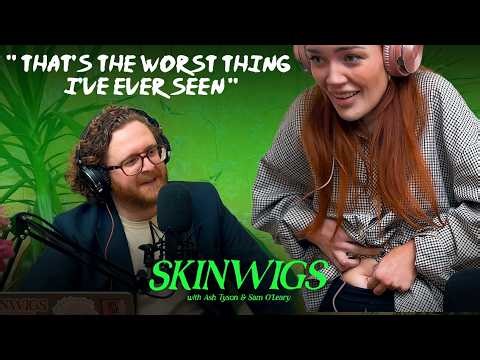 Ep 15: Ash Turns Her Belly Button Inside Out | SKINWIGS