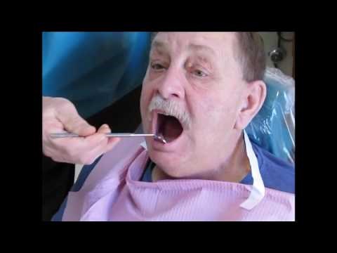 James Lynn Davis "Anchoring a Lower Denture with 2 Implants"