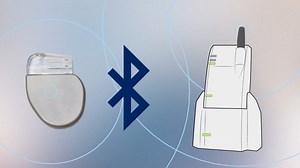Remote Monitoring For Your Pacemaker (MWHC)