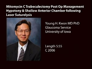 Mitomycin C Trabeculectomy Post Op Management: Hypotony & Shallow Anterior Chamber following Laser Suturelysis