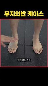 무지외반 케이스