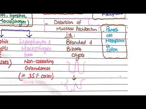 Crohn's Disease | Pathology