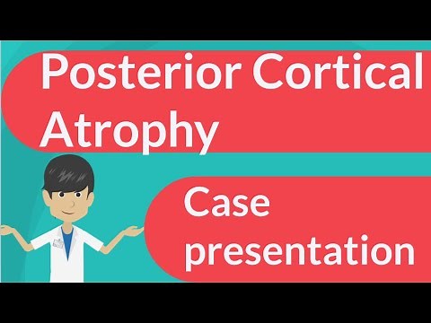 Posterior Cortical Atrophy; Case presentation