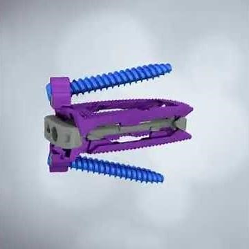 Globus Medical ELSA ATP