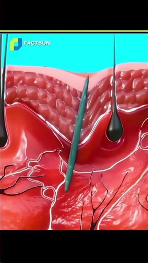 How a splinter can harm your body | Facts in hindi | #facts #factshorts #factsinhindi #shorts