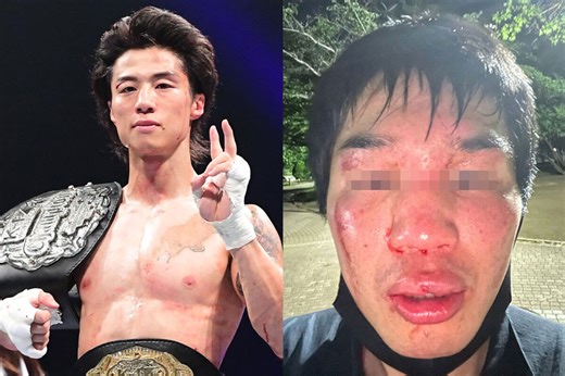 “不起訴でも許せない” K-1チャンピオンの「身の毛もよだつ暴行動画」に批判殺到　K-1プロデューサーに就任した須藤元気氏に見解を質したが「返答なし」 | デイリー新潮
