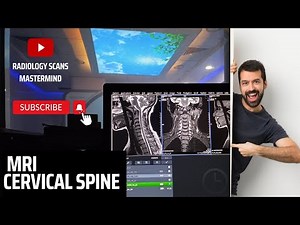 MRI CERVICAL SPINE ROUTINE