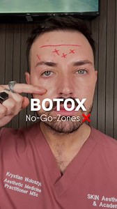 12K views · 191 reactions |  Botox No-Go Zones – Avoid These for a...