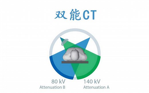 【医学成像100】65. 双能CT或能谱CT*美国医学物理师*西安电子科技大学