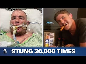 Man woke up from coma after being stung by thousands of bees