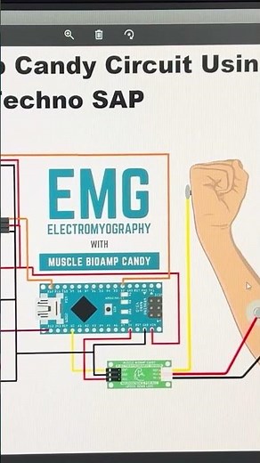 Building EMG Robotic Arm using muscle signals & ‪@Arduino‬ | Project by ‪@TechnoSAP‬ #arduino #emg