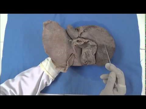 Descripción Anatómica del Hígado