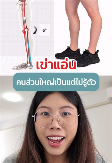 “เข่าแอ่น” คนส่วนใหญ่เป็นแต่ไม่รู้ตัว!! #แผ่นรองเท้าpbs #เท้าแบน #เข่าแอ่น #ปวดเข่า #ปวดเข่าเพราะเข่าเสื่อม