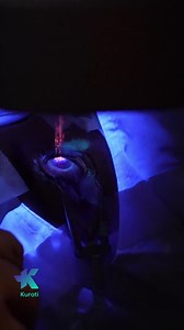 18K views · 1.7K reactions | ✨ Tu también puedes dejar el uso de...