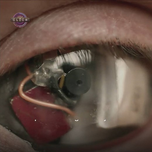 Meet the 'Eyeborg' - the man with a video camera for an eye. | BBC Click