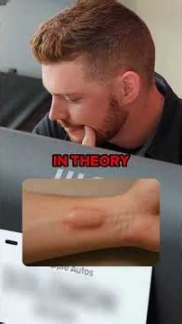 This Guy Actually Turned His Arm Into A Key Fob 🤯