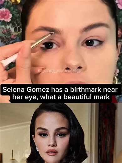 Selena Gomez has a birthmark near her eye, what a beautiful mark #selenagomez #selenator #selenators #selenatiktok