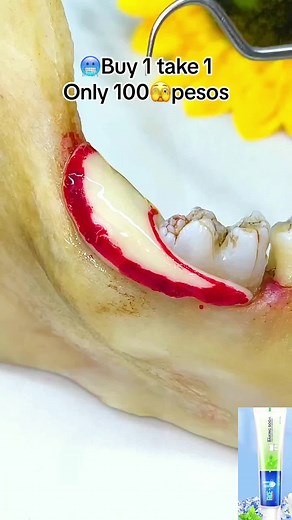 #tooth #toothpaste #fyp #fypシ #tiktok #tiktokshop #tiktokph #tiktokphilippines🇵🇭