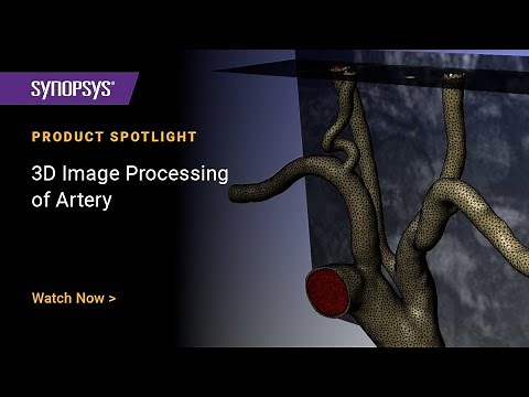 3D Image Processing of Artery in Simpleware