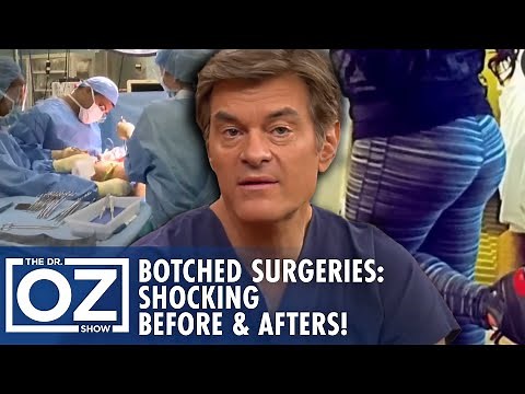 Botched Plastic Surgeries You Won’t Believe! Shocking Before & Afters | Oz Beauty & Skincare