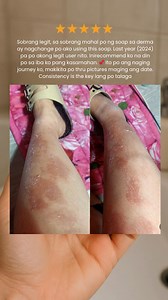 ✨ Transform your skin, transform your confidence! ✨ Say goodbye to dryness, itchiness, and irritation. Our Oatmeal Soap gently soothes, nourishes, and protects — perfect for sensitive skin. 💛 🌾 Calms redness 🌾 Locks in moisture 🌾 Smoothes rough patches Feel the glow. Feel the difference. Feel confident in your own skin. 💫 | Be Organic Bath & Body