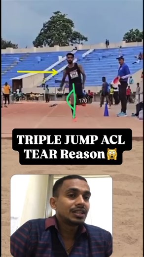 Binu Aquito on Instagram: "Knee valgus in a triple jumper is not a “knee problem” — it’s a force-control failure. During hop, step, or jump phases, excessive inward knee collapse increases frontal and transverse plane stress, especially when hip abductors and external rotators fail to control ground reaction forces. This faulty alignment overloads passive structures while reducing force transfer, directly affecting performance and injury risk. Common Injuries Associated with Knee Valgus: • ACL s
