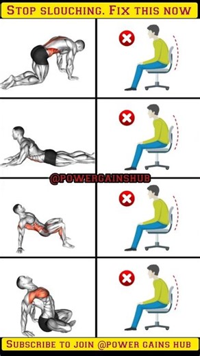 Neck, Back & Shoulder Posture Fix
