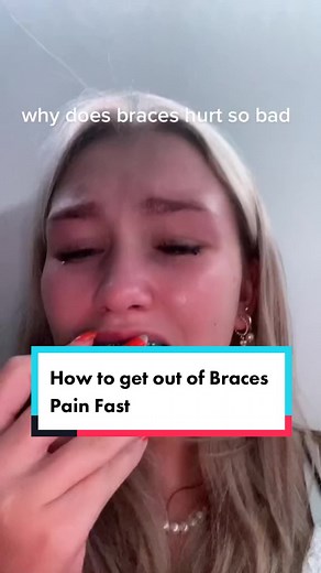 How to get out of braces Pain Fast 💨 #braces #learnontiktok