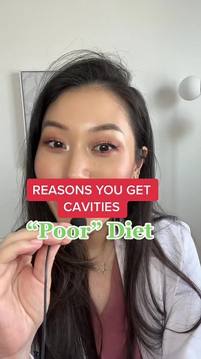 Preventing Tooth Decay: Understanding the Role of Diet