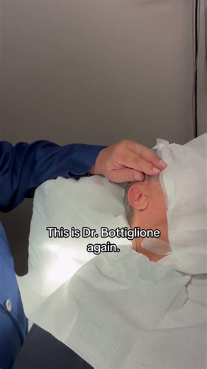 Dermatologist with 50 Years Experience Shows Large Cyst on Face (part 1)👨🏻‍⚕️