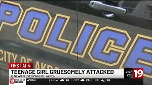 Akron Police Departmente say they did arrest one girl, 19 year old Kendall Worthy in connection with this attack. Worthy is being held in the Summit County Jail. Her bond is set at $100,000. | Brittany Wier