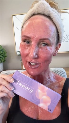 Immediately after under eye mesotherapy and full face, neck, chest and breast microneedling ❤️ I used Tesoro Collagen from Acecosm.com discount code STACY10 FREE tutorials at Rumble.com/GorgeouslyAging #microneedling #mesotherapy #antiagingtreatment #facialrejuvenation @acecosm | Gorgeously Aging