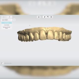 With Dental System you design with a leading dental CAD software. 🦷 The latest version of Dental System includes brand new features like Model Builder Express which uses AI to prepare proposals for unsectional models. Watch the video and see how quickly you can inspect and correct it, if needed. Find out more on how you can get started 🔗 https://ow.ly/Wb7J50R30hT #3Shape #DentalSystem #DentalCAD #DigitalDentistry | 3Shape