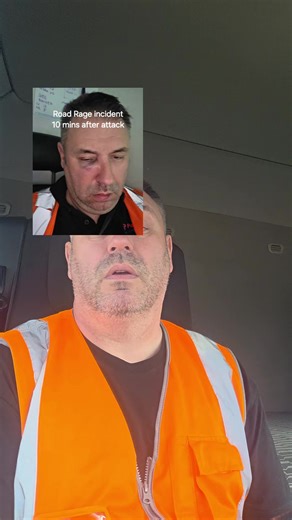 Road Rage Attack: Severe Injuries & PTSD After August Incident