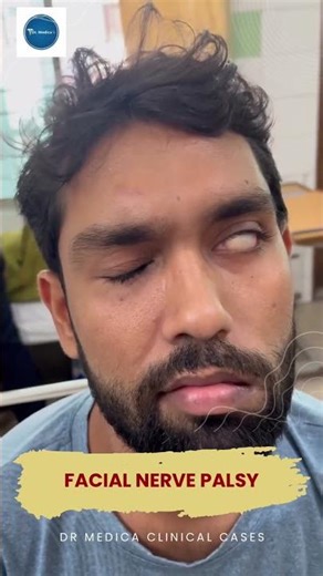 Facial nerve palsy || Dr Medica Clinical Cases || Diagnosis || Education ||