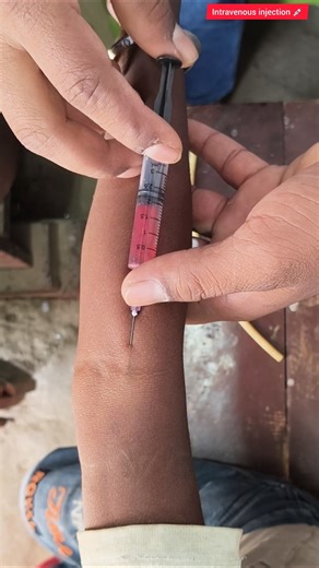 iv injection technique 💉 ! #shorts #viralshorts #doctor #injection