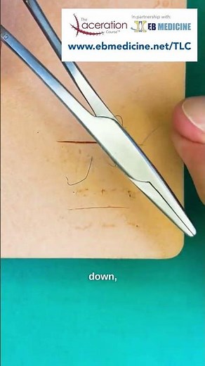 Horizontal Mattress Stitch