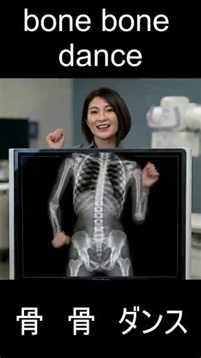 骨 骨 ダンス レントゲン03 bone bone bone dance X-ray03#short