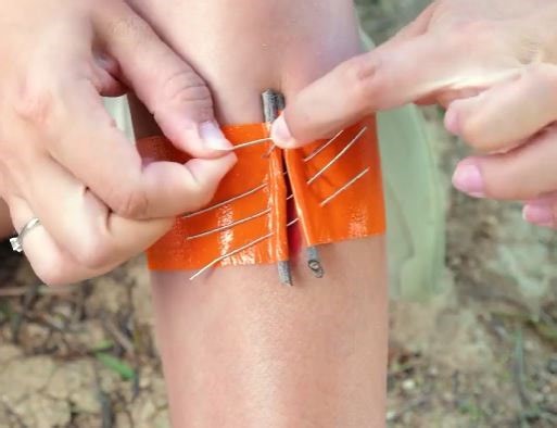 Quick First Aid Tips for Summer | 5-Minute Crafts