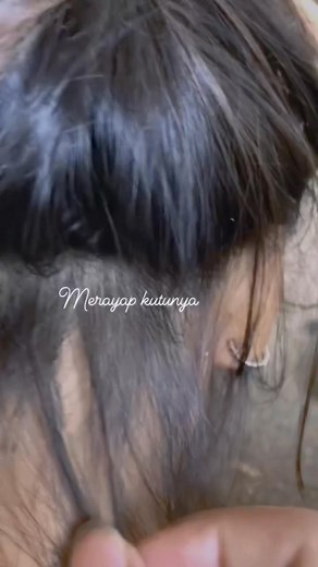 The lice are crawling #lice #hair #kuto | Desi Sriwardiyah