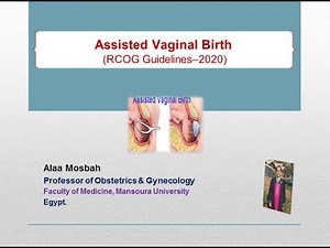 Assisted Vaginal Birth (RCOG Guidelines –2020)