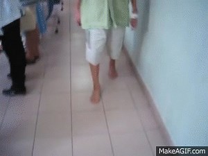 High steppage gait on Make a GIF