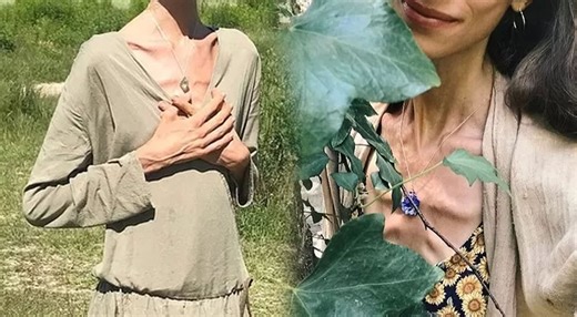 Muere QUERIDA influencer por DESNUTRICIÓN tras seguir dieta estricta: Pesaba 22 kilos y su última foto dejó en SHOCK