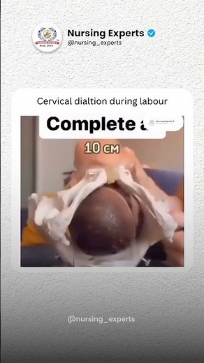 Cervical Dilation Explained 🤰 | 0–10 cm Labour Process | What Every Nursing Student Must Know