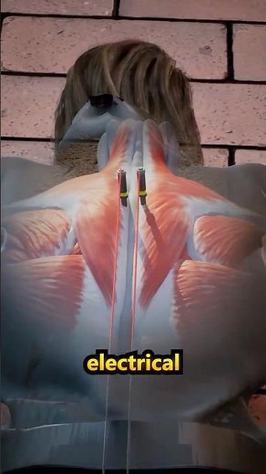 How Do Taser Gun Works