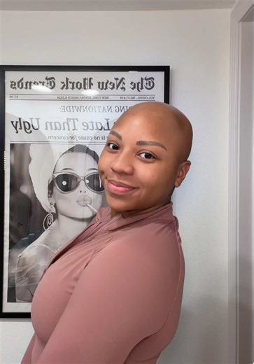 my all-time favorite hairstyle ✨ #hairstyle #hairtok #alopecia | hair styles