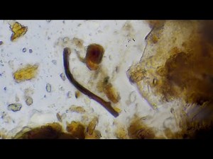 Bio-Complete Compost under microscope! The HOLY GRAIL of farming!