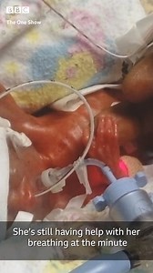 The remarkable story of the smallest baby ever born in Britain. | The One Show